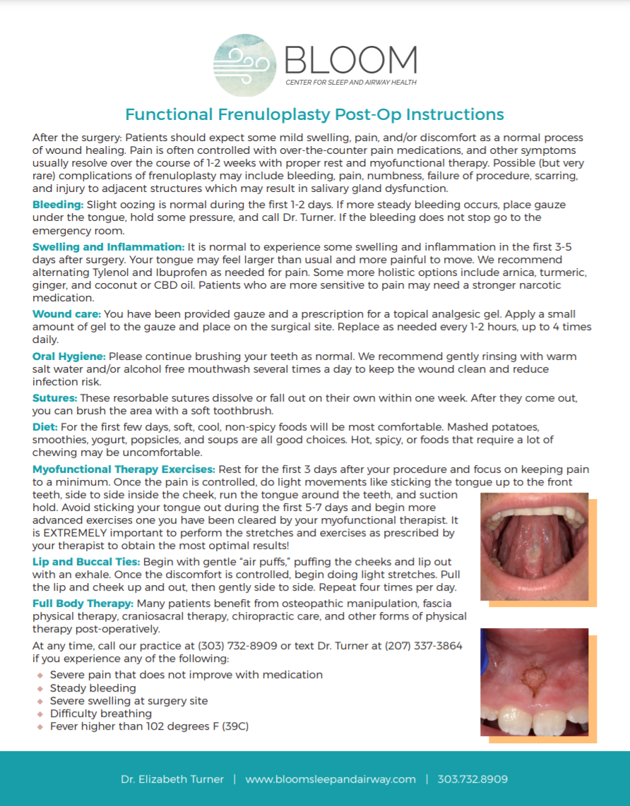 Frenuloplasty Post-Op Instructions Frenuloplasty Post-Op Instructions